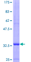 12.5% SDS-PAGE Stained with Coomassie Blue.